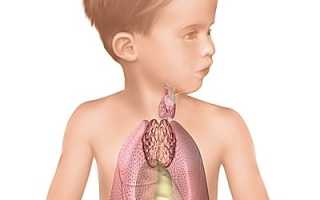 Тимомегалия